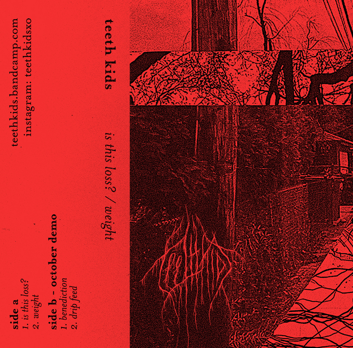 Teeth Kids Is This Loss/Weight EP cassette insert